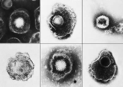 science is interesting: herpesviridae classification