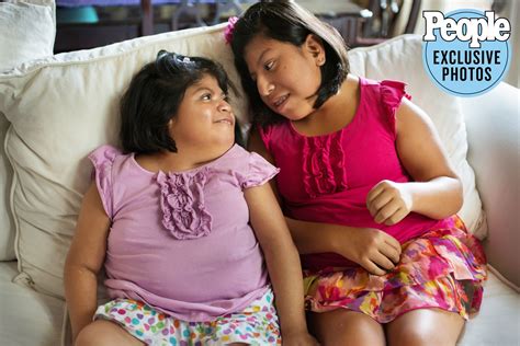 Josie Hull and Teresa Cajas: Formerly Conjoined Twins 21 Years Later