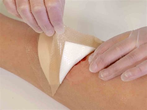 How to change wound dressings | Mölnlycke Advantage