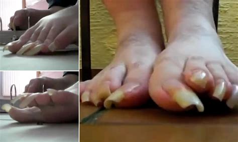 World Longest Toe Nails