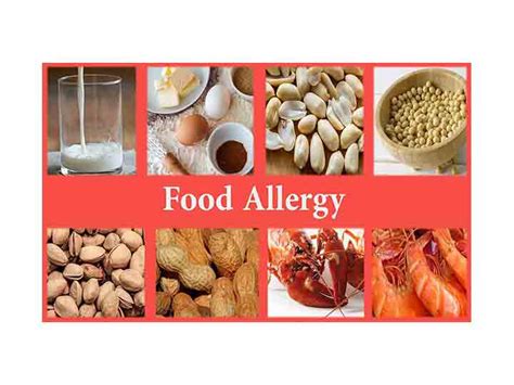 Soy Allergy, Symptoms, Best Treatment, Management, Bardhaman, WB ...