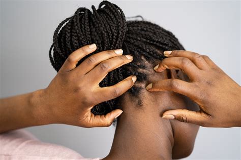 The Truth Behind the Myth That Black People Can't Get Lice | Allure