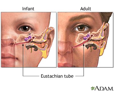 Ear Clogged Sinus Symptoms