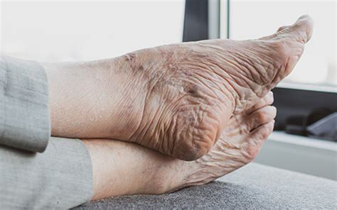 Aging Feet Changes and Common Problems - Massage and Spa Blog