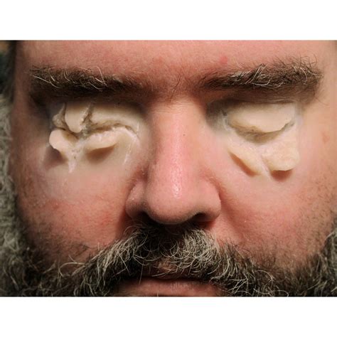 Gouged Out Eyes Prosthetics // Encapsulated Silicone // Ripped Out Eyes ...