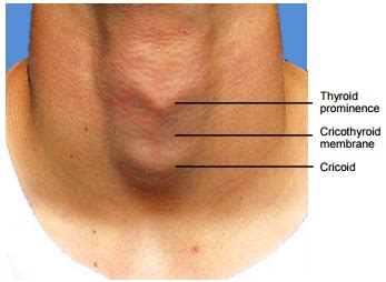 Thyroid Cartilage Surface Anatomy