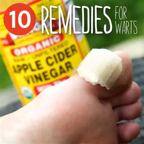 Old Fashioned Home Remedies Wart Removal - The Homestead Survival