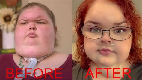 1000 Lb Sisters: Tammy Slaton Ready To Undergo Skin Removal Surgery ...