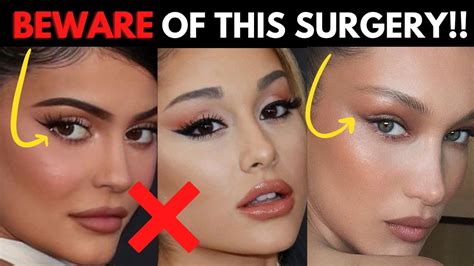 Why You'll REGRET Getting this Trendy Plastic Surgery Procedure (Fox ...