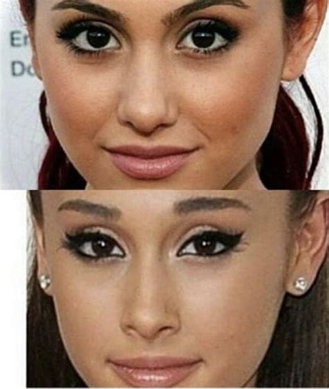 Pin by excluir conta on Tort | Rhinoplasty nose jobs, Ariana grande ...