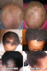 jamaican-black-castor-oil-for-hair-before-after-photos.jpg | Hair Mag