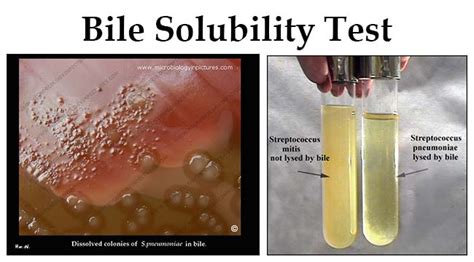 Bile Solubility Test- Principle, Reagents, Procedure and Result ...