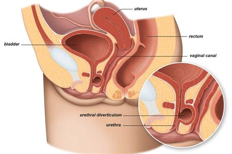 Urologist Singapore | Urohealth Medical Clinic