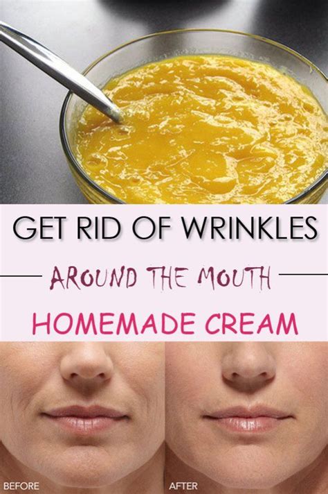 Get rid of wrinkles around the mouth | Anti aging homemade, Homemade ...