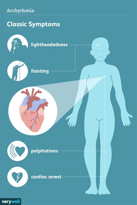 Cardiac Arrhythmias: Signs and Symptoms