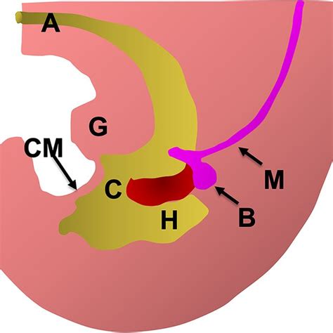 Physical exam findings in a 3-month-old girl with cloacal malformation ...