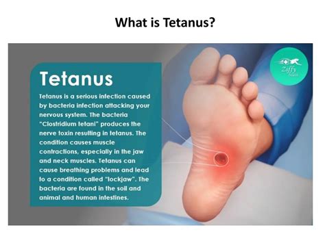 What is Tetanus? by ziffytech07 - Issuu