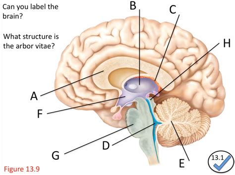 Brain Midsagittal View Unlabeled