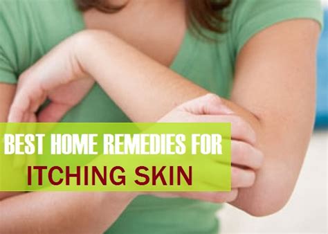 Best Herbal Home Remedies for Itching Skin At Home