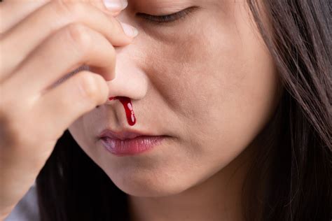 Bleeding Disorder Types, Causes, and Treatments - EroFound