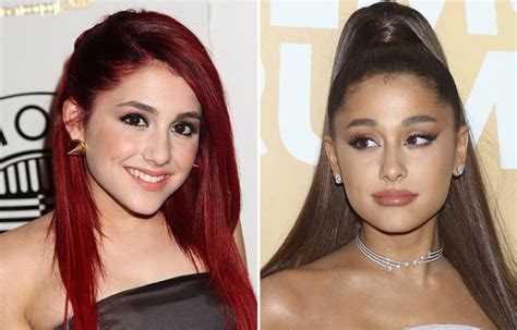 What is True in Ariana Grande Plastic Surgery Speculation?