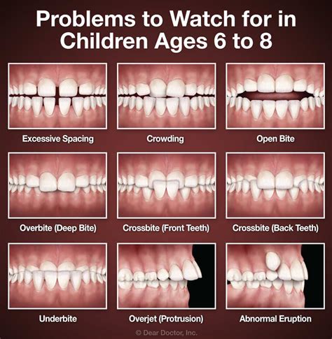 Early Treatment | Progressive Orthodontics | Jefferson City Missouri