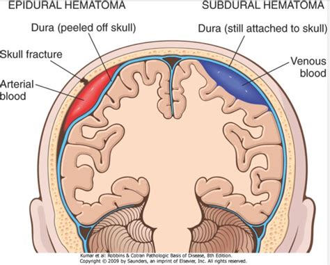 Pin on Computed Tomography