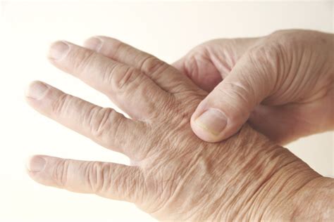 Does clicking your fingers increase your chances of getting arthritis ...