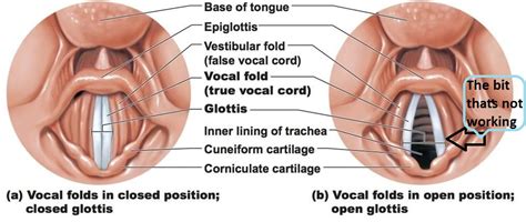 Oh dear, I've lost my voice! - Novar Music Learning Centre