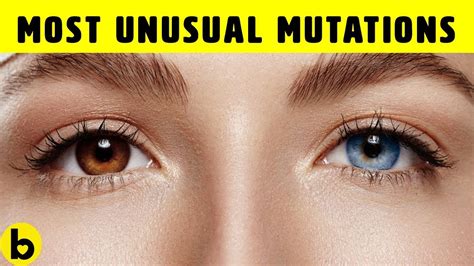 Genetic Mutation In Human Eyes