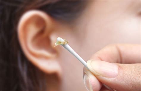 What is ear wax? | Anglia Ear Care Solutions