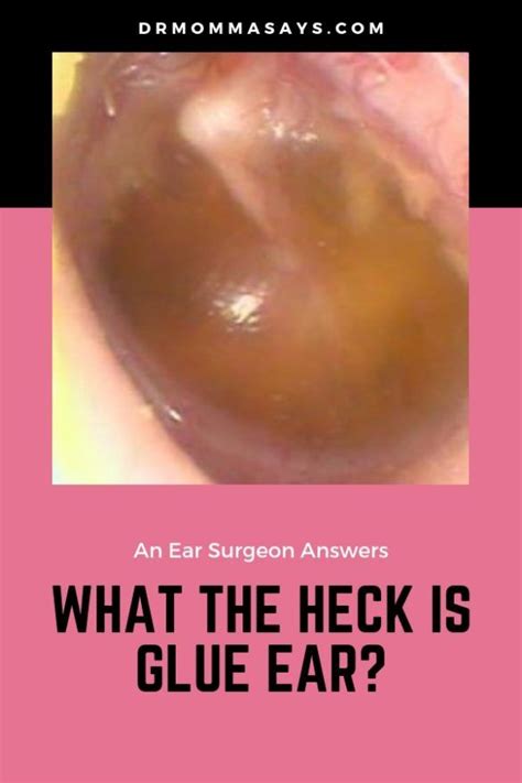 What the HECK is Glue Ear? - Dr Momma Says Positive Parenting ...