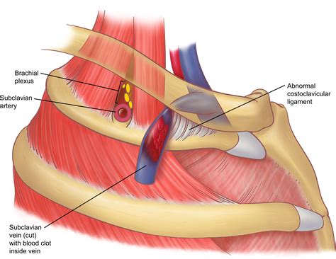 Anatomy of the Thoracic Outlet - Thoracic Surgery Clinics