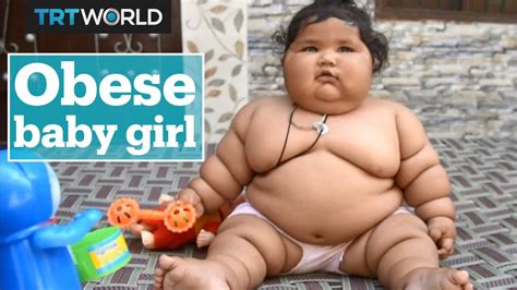 Obese baby leaves doctors confused - YouTube