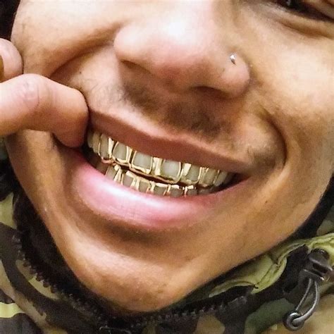 rosendage.org | Grills teeth, Gold teeth grills, Gold grill