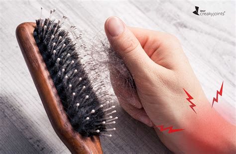 Lupus Patients Who Experience Hair Loss Might Have Higher Disease Activity