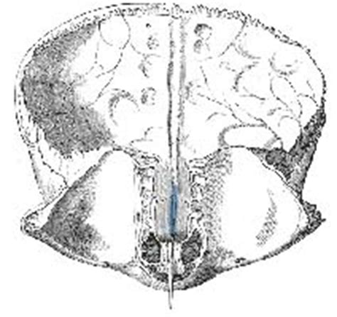 Quia - osteology : vault bones and features