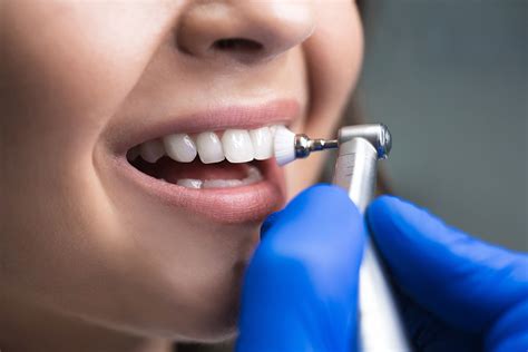 Teeth Cleaning Procedure and all about it | Healing Clinic Turkey