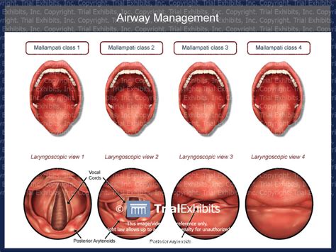 Anatomy Airway Intubation View