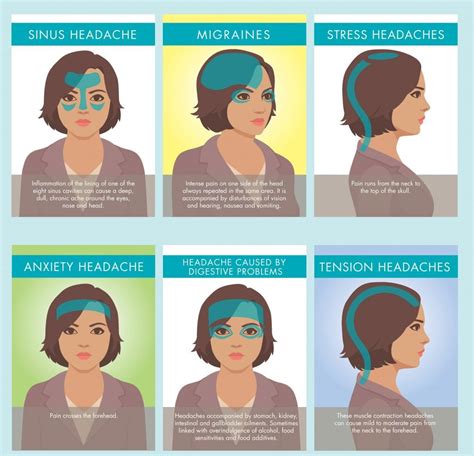 Resize types of headaches | Milton Chiropractic Clinic