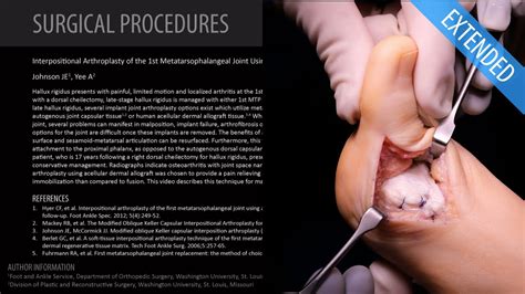 Arthroplasty of the 1st MTP Joint Using Acellular Allograft - Extended ...