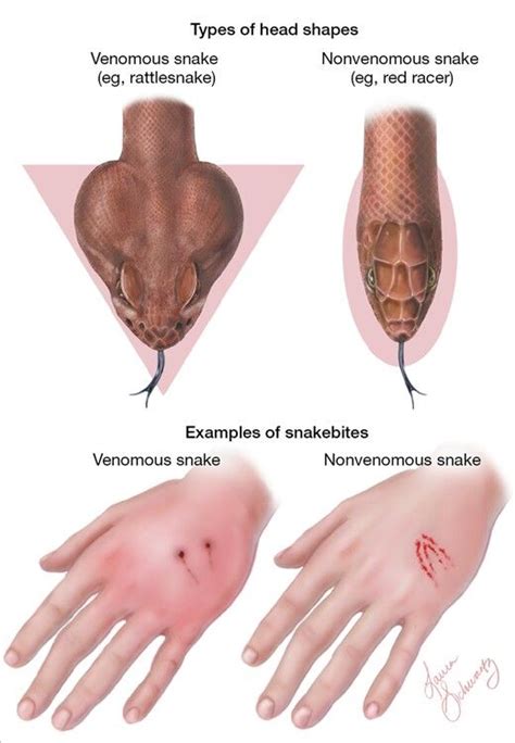 Venomous vs nonvenomous snakes | Wilderness survival skills, Survival ...