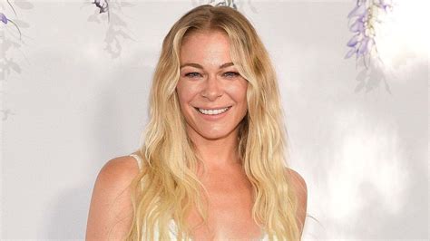 LeAnn Rimes bares all in post embracing her psoriasis: ‘This is my time ...