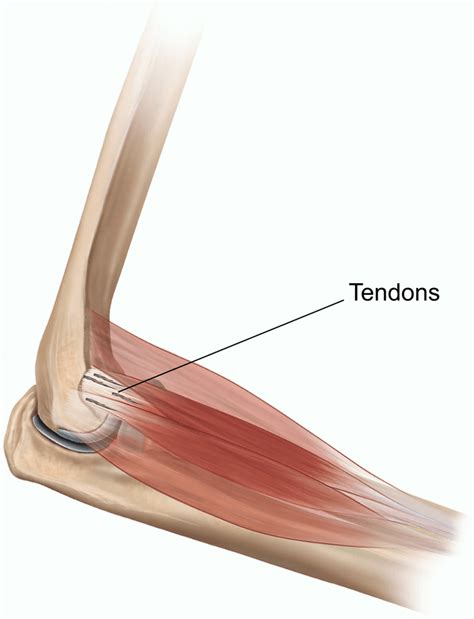 Flexor Tendonitis Of The Elbow: Anatomy, Symptoms, Causes Treatments ...