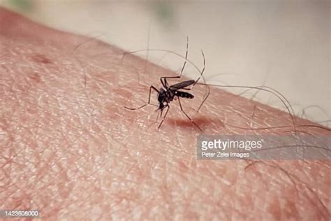 57 Asian Tiger Mosquito Bite Stock Photos, High-Res Pictures, and ...