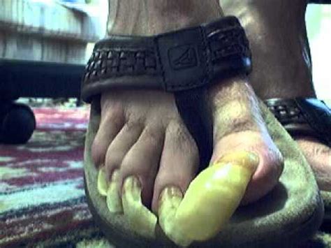 Long Male Toenails (23 months growth) and Flip Flops - YouTube