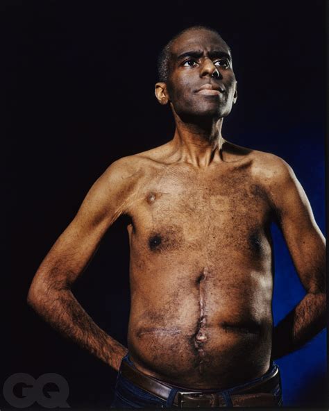 Scar Stories: The Toll of Colon Cancer | GQ