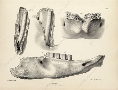 Mylodon prehistoric mammal fossil teeth, 19th century - Stock Image ...