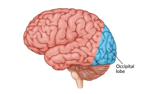 Occipital Lobe Stroke: Effects, Rehabilitation, & Outlook