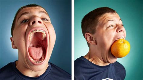 USA teenager has the biggest mouth in the world! | Guinness World Records